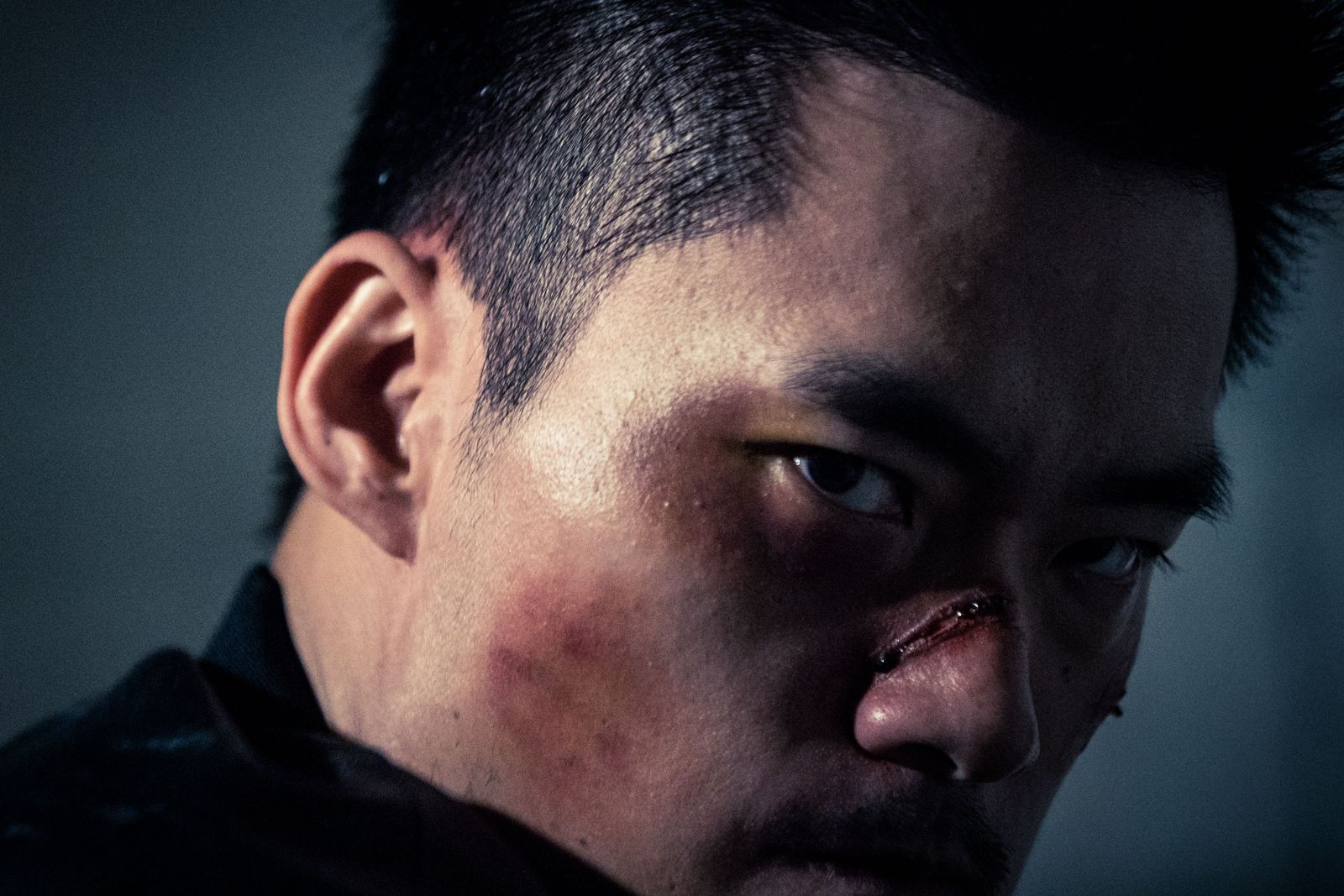 Close-up of Kuang Feng with a bruised cheek